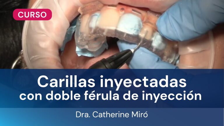 Curso de Carillas Inyectadas: Guía Completa