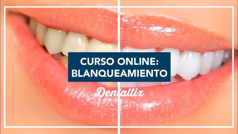 Curso de Blanqueamiento Dental: Guía Completa para Profesionales