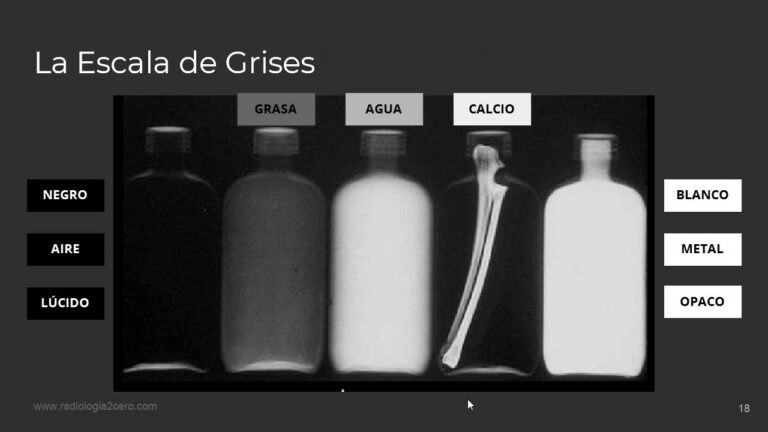 Las 5 densidades básicas en radiología