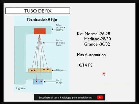 Componentes Esenciales del Mam&oacute;grafo
